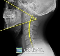 세란의원 이미지