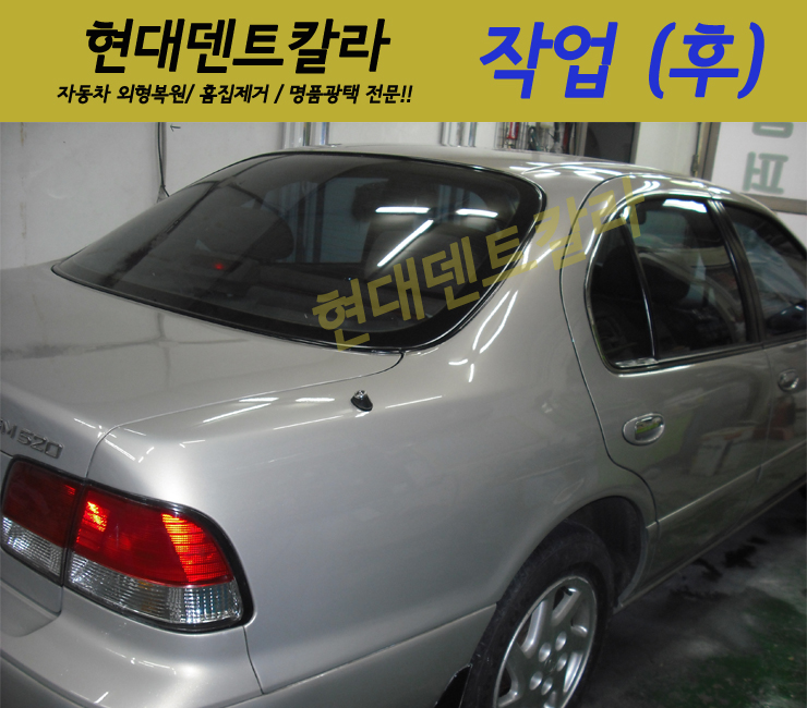 현대덴트칼라 이미지