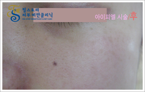 필스토리의원 이미지