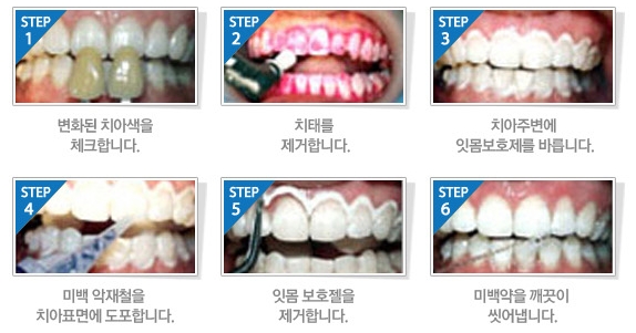서울황제치과의원 이미지