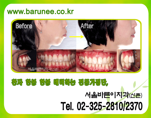 허브스트 이미지