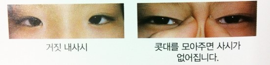 연세브라이튼안과의원 이미지