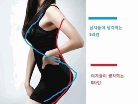 S라인 이미지