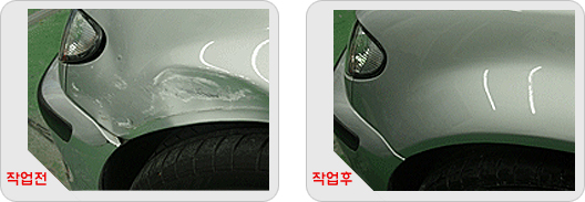 메트로덴트칼라 이미지
