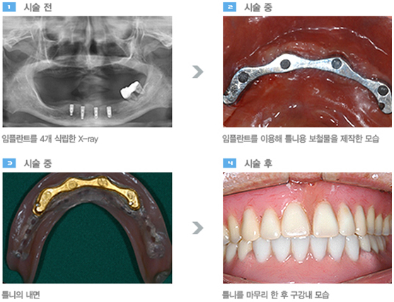 서울신세계치과 이미지