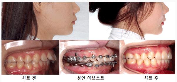 허브스트 이미지