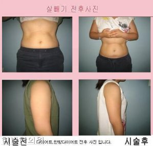한빛한의원 이미지