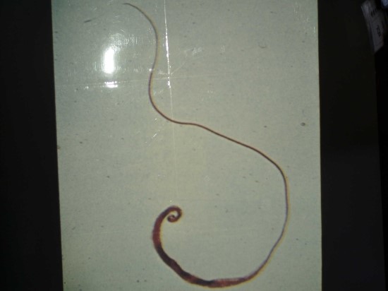 편충(鞭蟲, Trichuris trichiura) Whipworm : 네이버 블로그