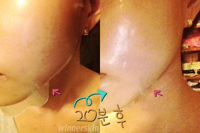 위너아이스 이미지