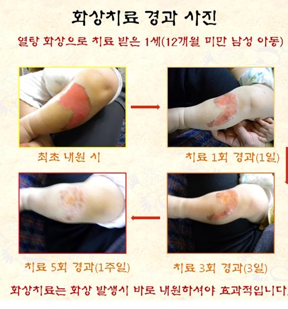최*익 이미지
