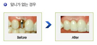 보스톤서울치과 이미지