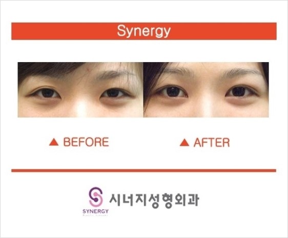 에스라인 이미지