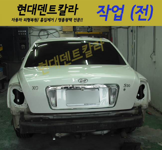 현대덴트칼라 이미지