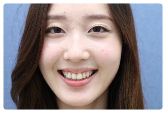 역삼옥스치과 이미지