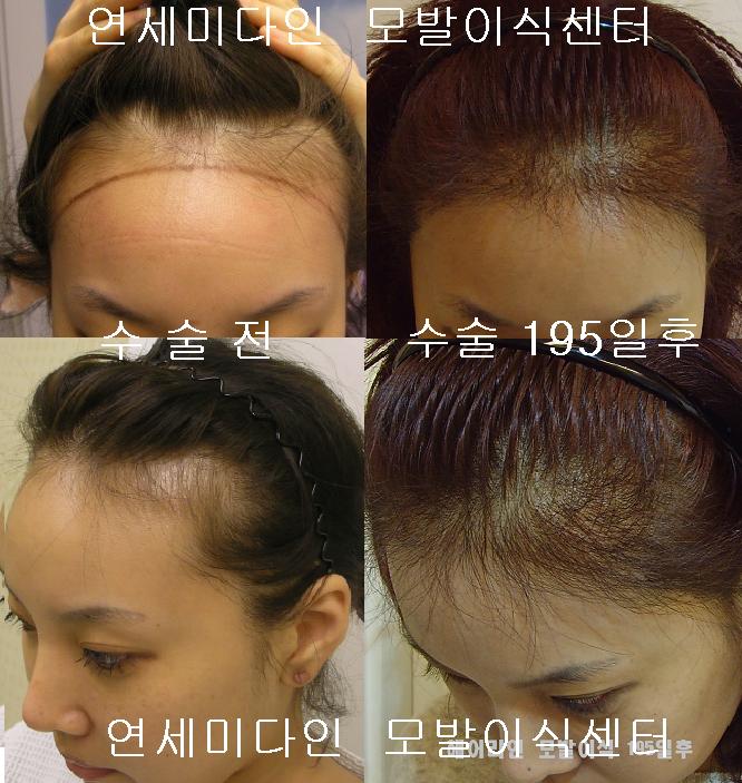 미다인헤어 이미지
