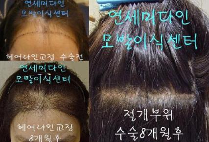 미다인헤어 이미지
