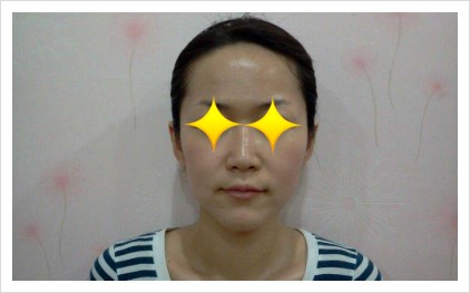 샤넬림스킨케어 이미지