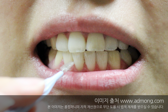 임플라인치과 이미지