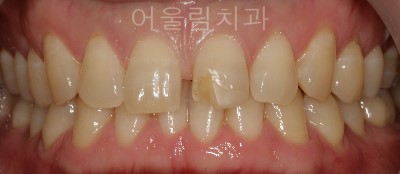 어울림치과의원 이미지