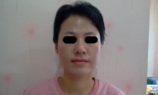 샤넬림스킨케어 이미지