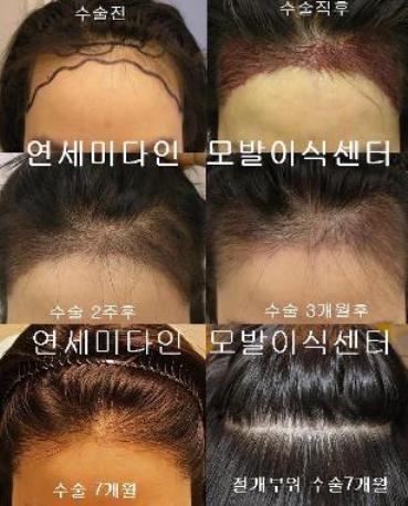 미다인헤어 이미지
