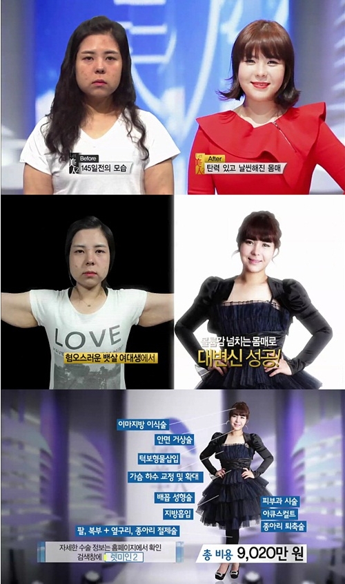 렛미인피부 이미지
