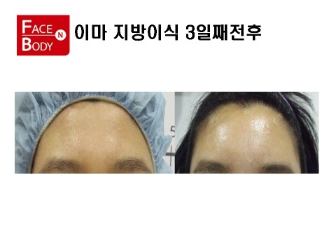 파인에프엔비 이미지