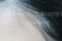 도로시헤어라인 이미지