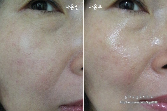 하이뷰티 이미지