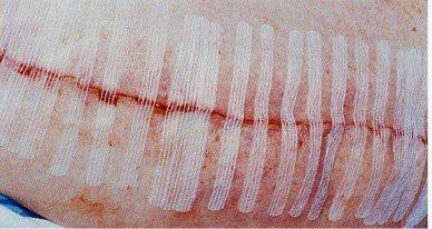 실과바늘 이미지
