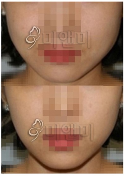 미앤미의원 이미지