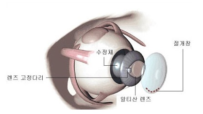 밝은누리 이미지