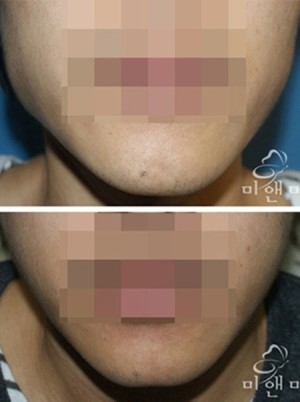 미앤미의원 이미지