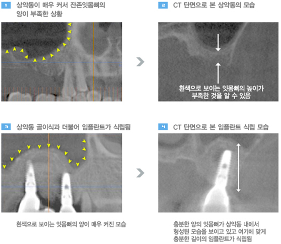 서울신세계치과 이미지