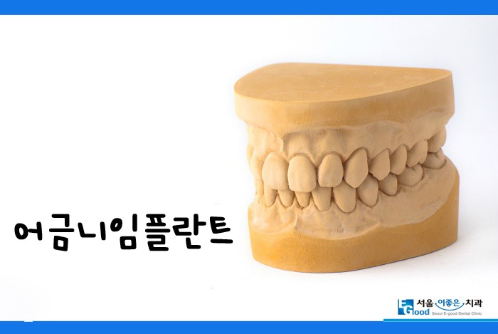서울이좋은치과 이미지