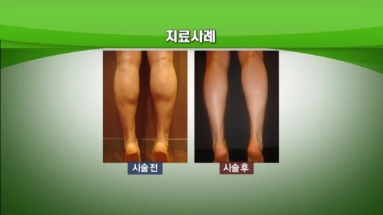 PC클리닉 이미지
