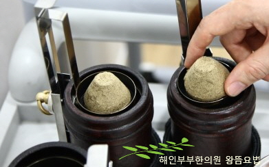 쑥뜸의 효능과 쑥뜸을 뜨면 좋은 기본 혈자리 - 수원쑥뜸한의원, 해인부부한의원 : 네이버 블로그