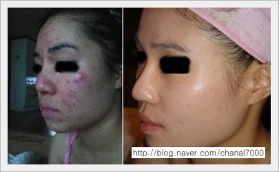 샤넬림스킨케어 이미지