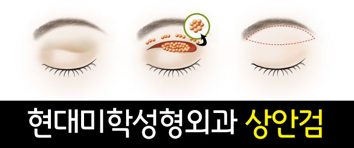 황호성형외과 이미지