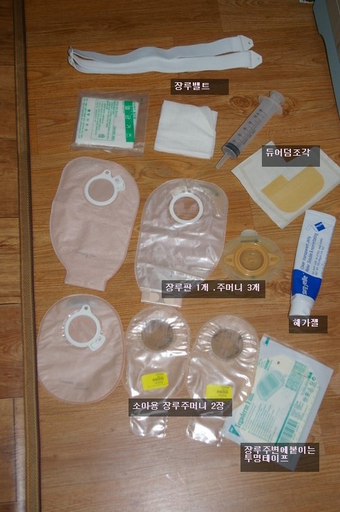장루(stoma)의 정의, 종류 , 절차, 간호, 세척 방법 : 네이버 블로그