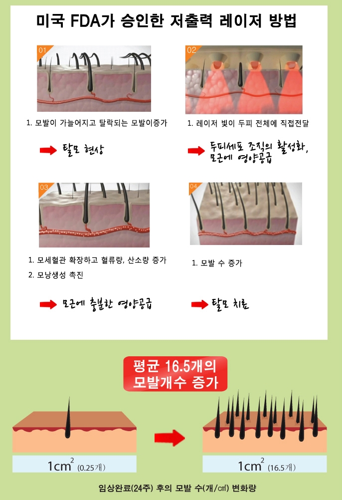 오아제 이미지