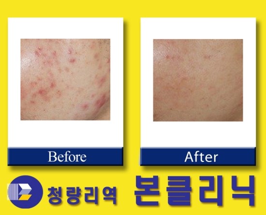 본피부과 이미지
