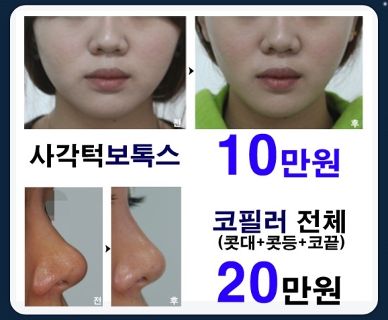 본피부과 이미지