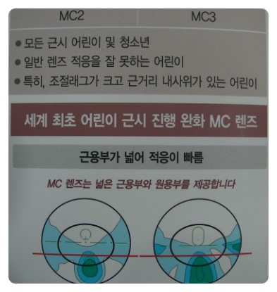 엠씨렌즈 이미지