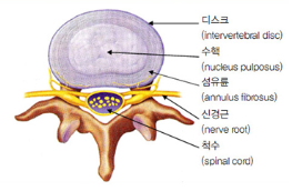 [허리디스크]추간판 탈출증(Herniated Intervertebral Disc: HIVD) : 네이버 블로그