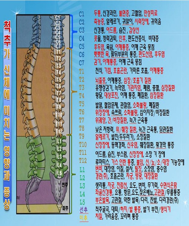 바른척추 이미지