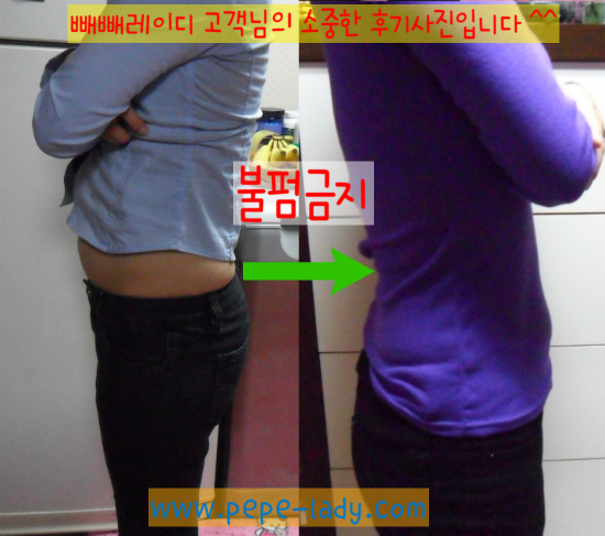 로빼 이미지
