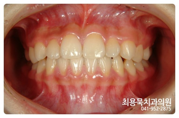 최용묵치과의원 이미지