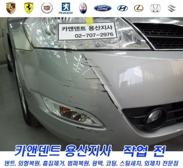 카앤덴트 이미지
