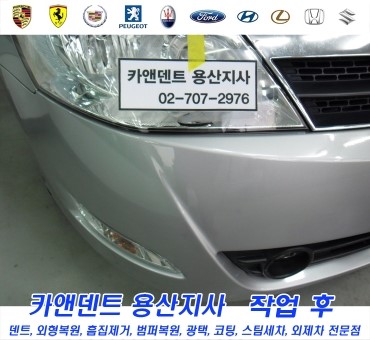 카앤덴트 이미지